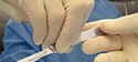 Donazione organi
