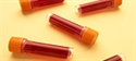 Donare il sangue: la nostra inchiesta