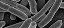 Infezione da E. coli in Germania: pulire bene gli ortaggi