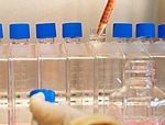 Cellule staminali: la realtà e le speranze